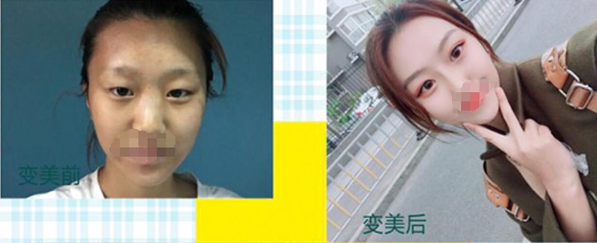 点击查看原图