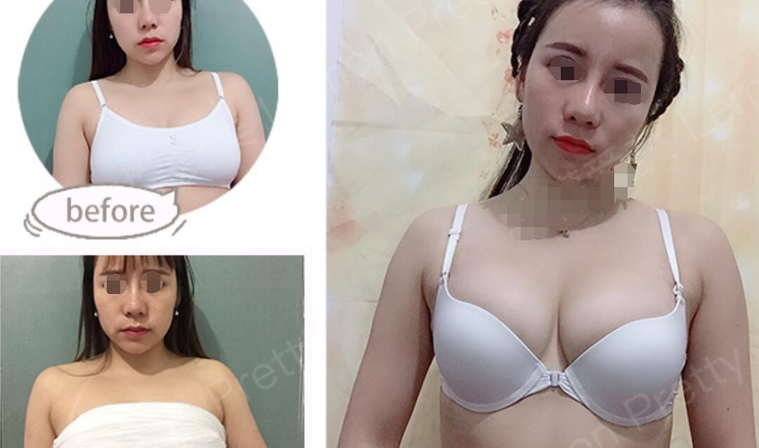 点击查看原图