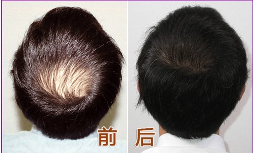 点击查看原图