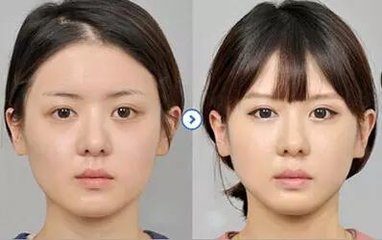 点击查看原图