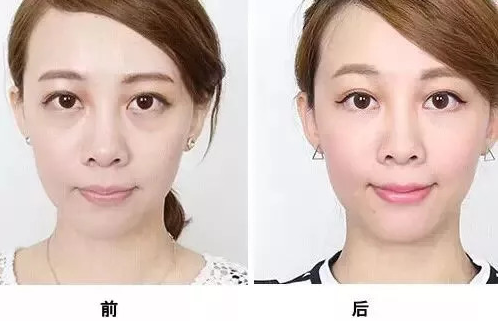 点击查看原图
