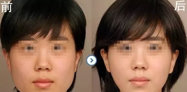 点击查看原图