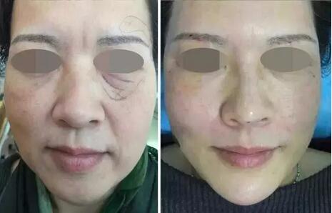 点击查看原图