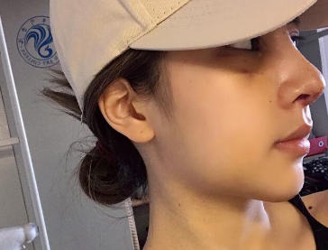 点击查看原图