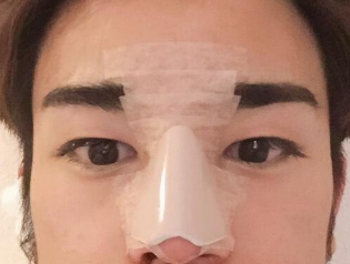 点击查看原图