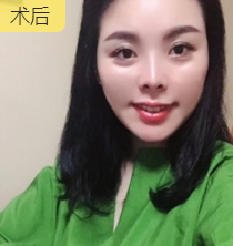 点击查看原图