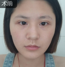 点击查看原图
