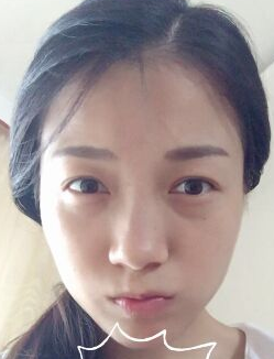 点击查看原图