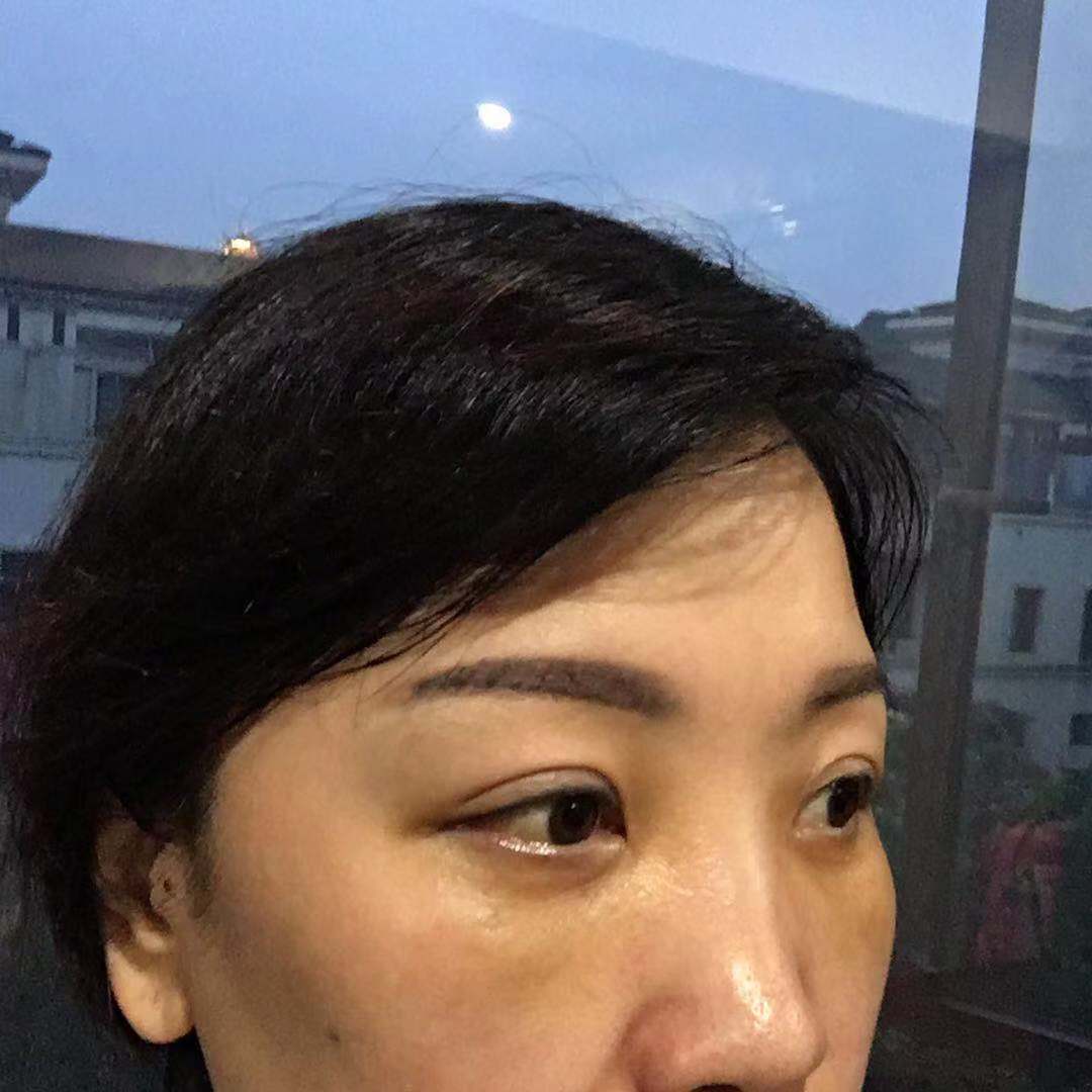 点击查看原图