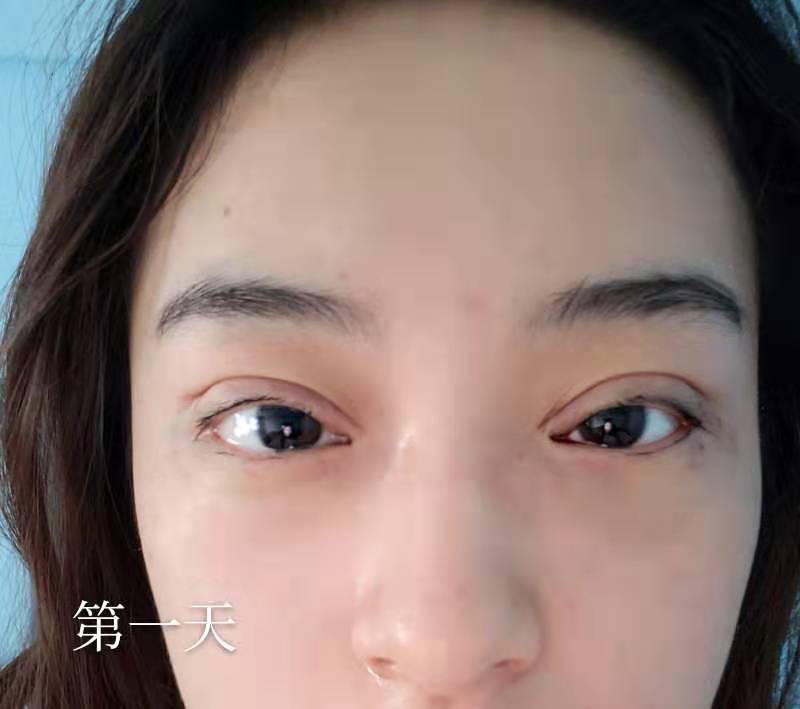点击查看原图