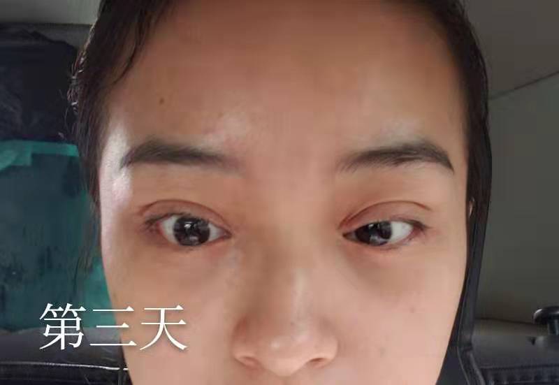 点击查看原图