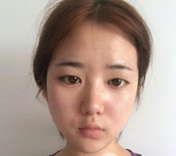 点击查看原图