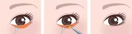 点击查看原图