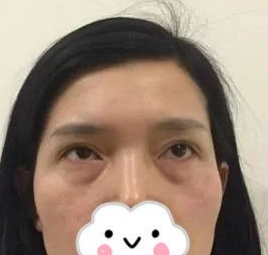 点击查看原图