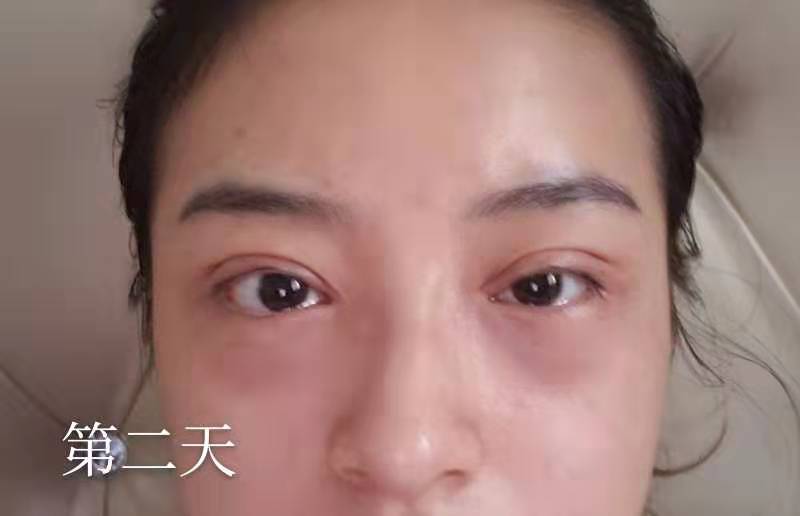点击查看原图