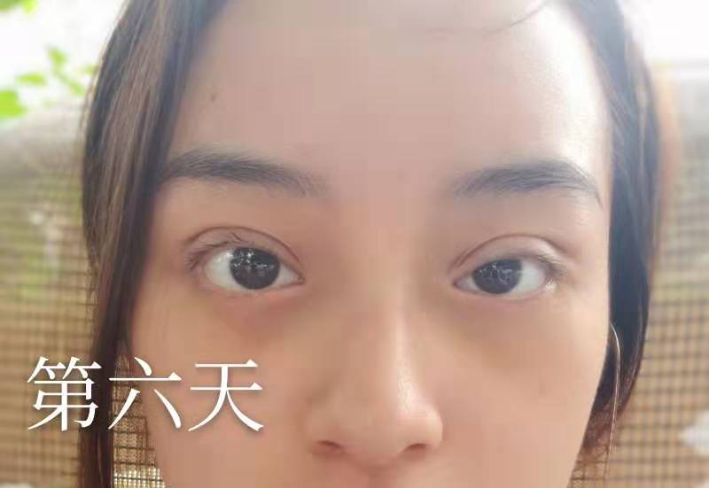 点击查看原图