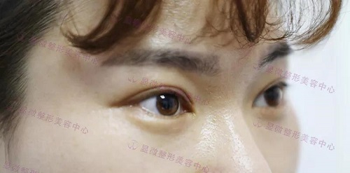 点击查看原图