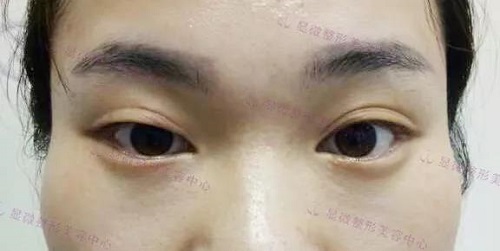 点击查看原图