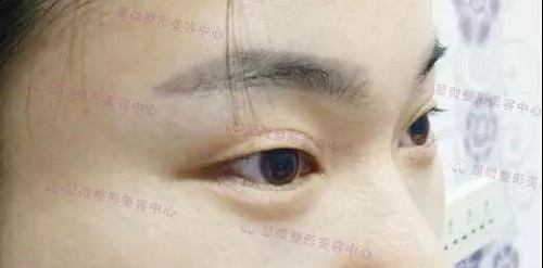 点击查看原图
