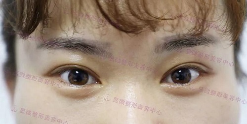 点击查看原图