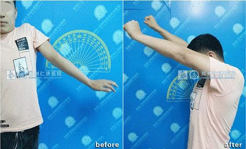 点击查看原图