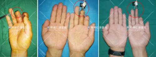 点击查看原图
